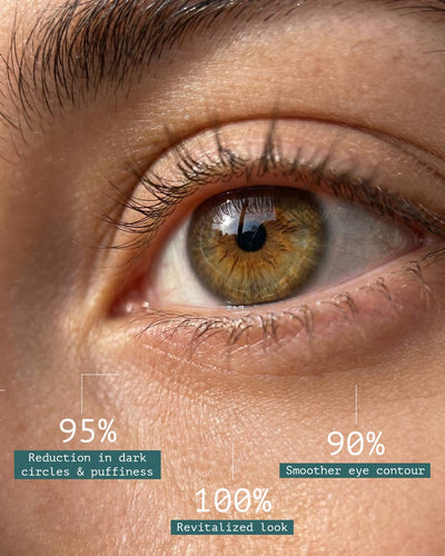 The Eye Complex